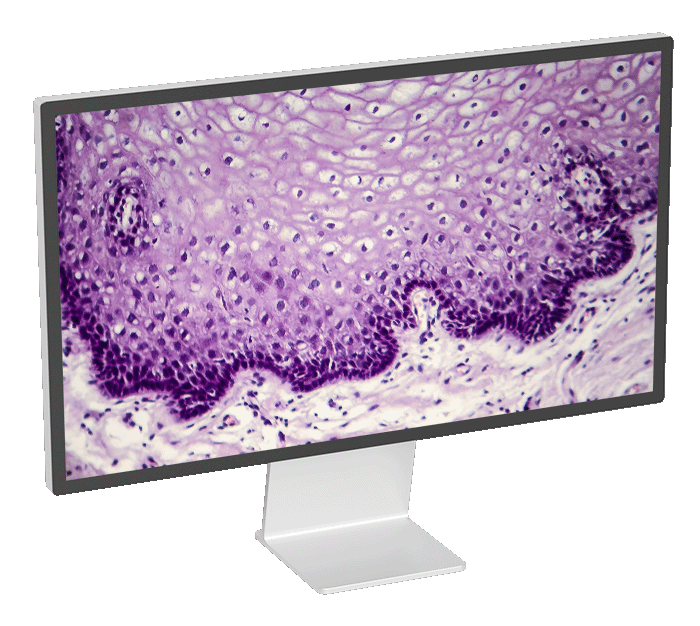 pathology slide on a computer screen