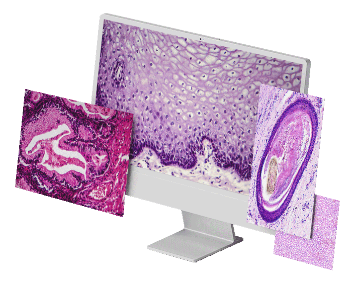 computer showing slides of pathology