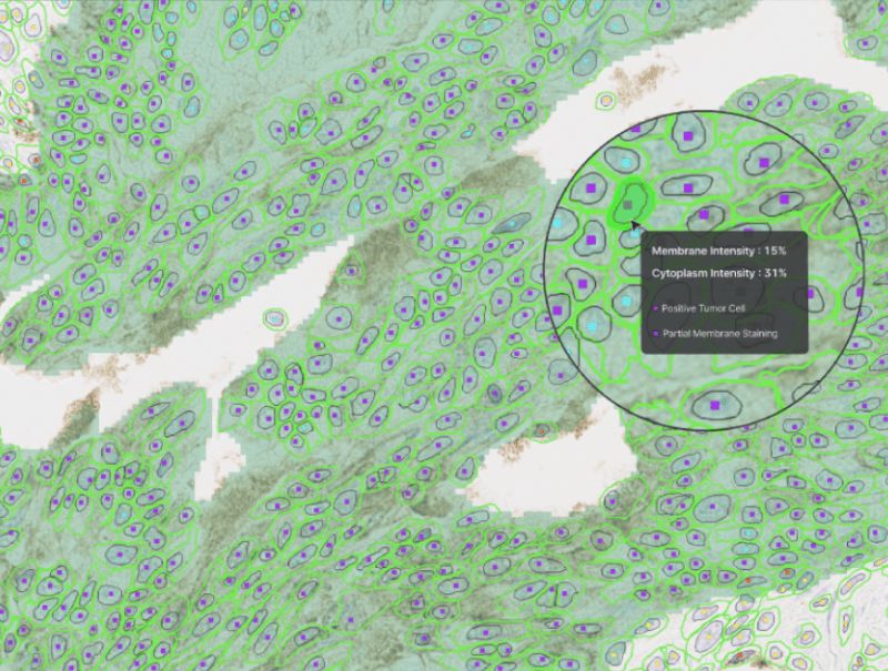 Lunit SCOPE uIHC is available in PathFlow
