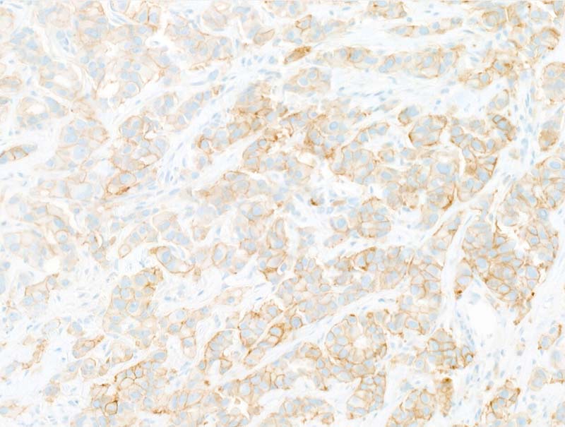 slide of Mindpeak Breast HER2 RoI