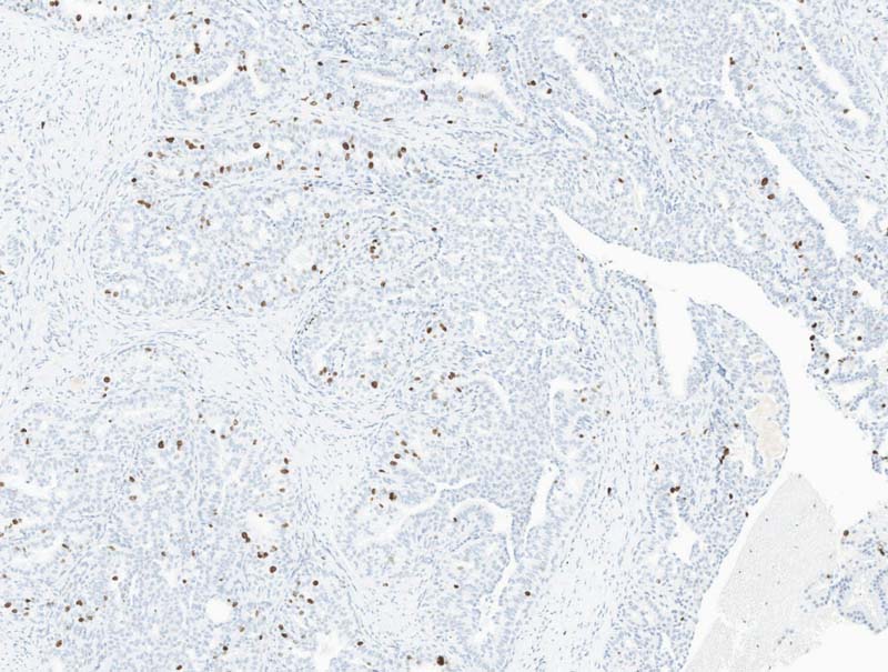 slide of Mindpeak Breast Ki-67 4R