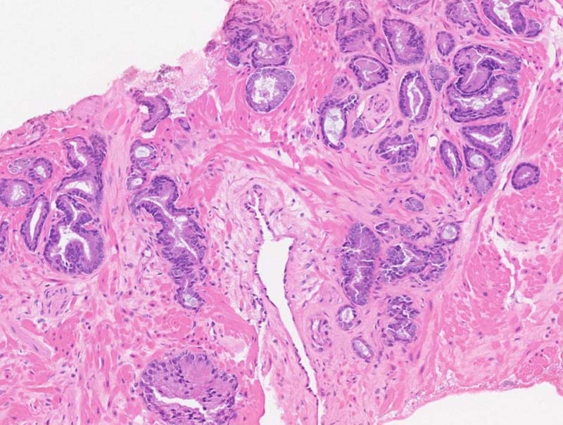 slide of Mindpeak Prostate H&E