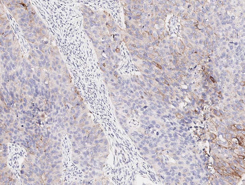 slide of Mindpeak Urothel PD-L1