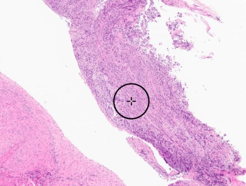 Paige.ai's PanCancer is available in Pathflow