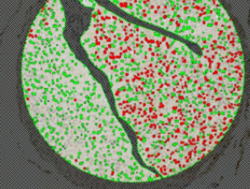 VisioPharm's Annexin 10, Bladder Cancer is available for Pathflow.