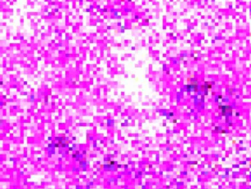 VisioPharm's Cell Detection AI (IMC), is available in Pathflow