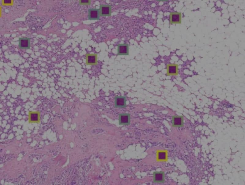 Primaa's Cleo Breast is available for Pathflow