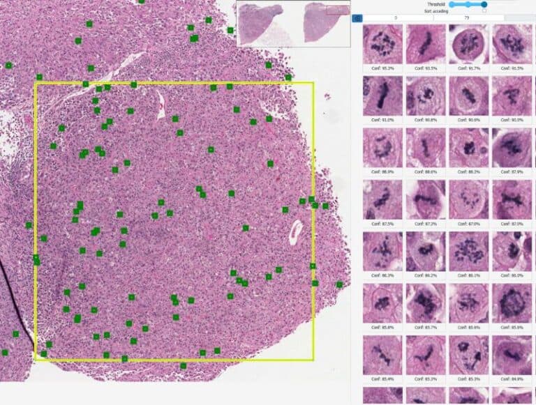 Mitotic Cell Counting Algorithm Screenshot