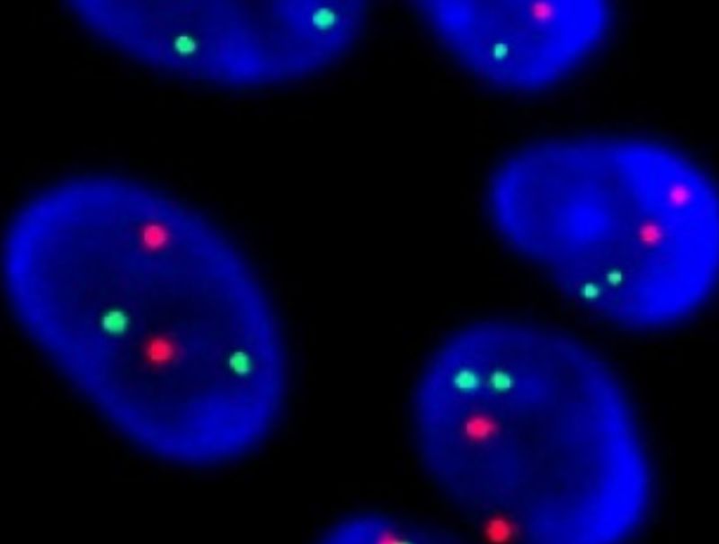 VisioPharm's HER2-FISH, Breast Cancer is available in Pathflow