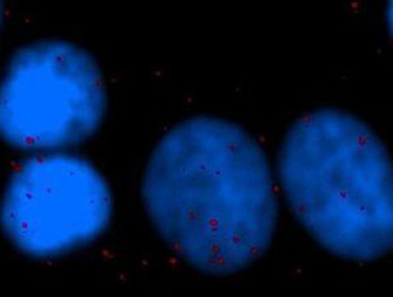 VisioPharm's HER2/HER3, Breast Cancer is available in Pathflow