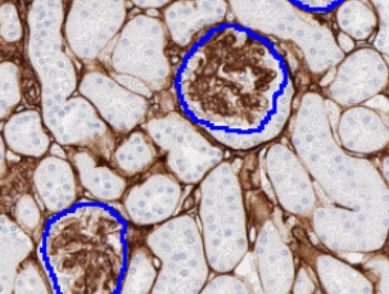VisioPharm's IHC Glomerulus Detection is available in Pathflow.