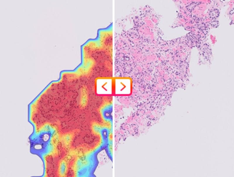 Ibex's Ibex Prostate is available in Pathflow