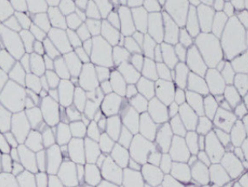 VisioPharm's Iron Hematoxylin, Adipose Tissue is available in Pathflow