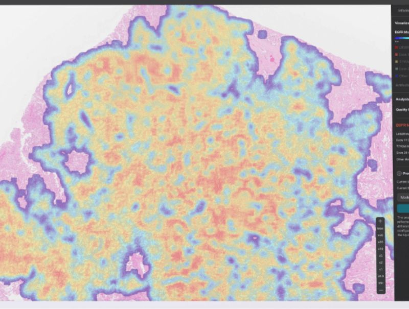 Lunit's Lunit SCOPE GP, is available in Pathflow