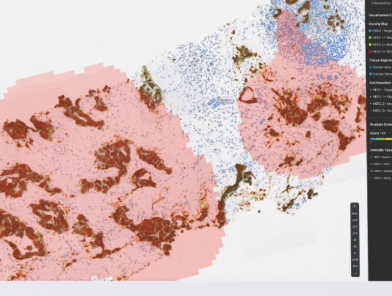 Lunit's, Lunit SCOPE HER2 is available in Pathflow