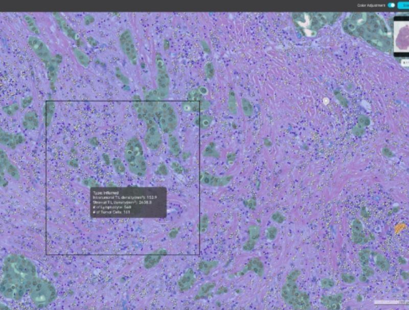 Lunit's Lunit SCOPE IO is available in Pathflow