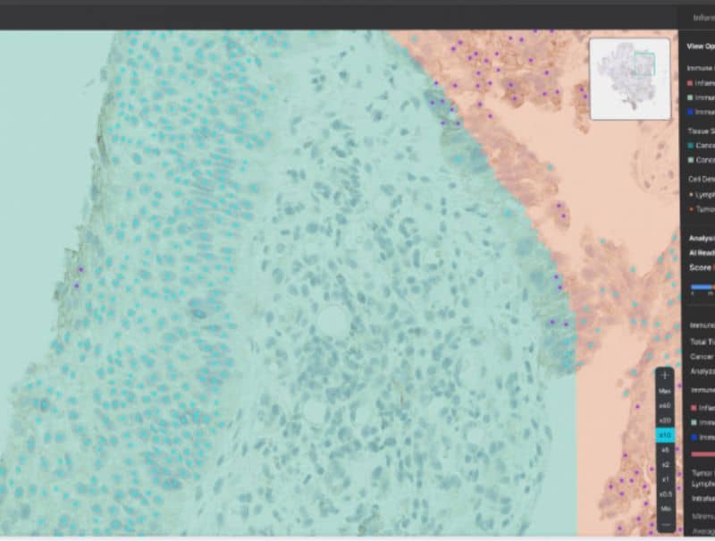 Lunit's, Lunit SCOPE PD-L1 is available in Pathflow