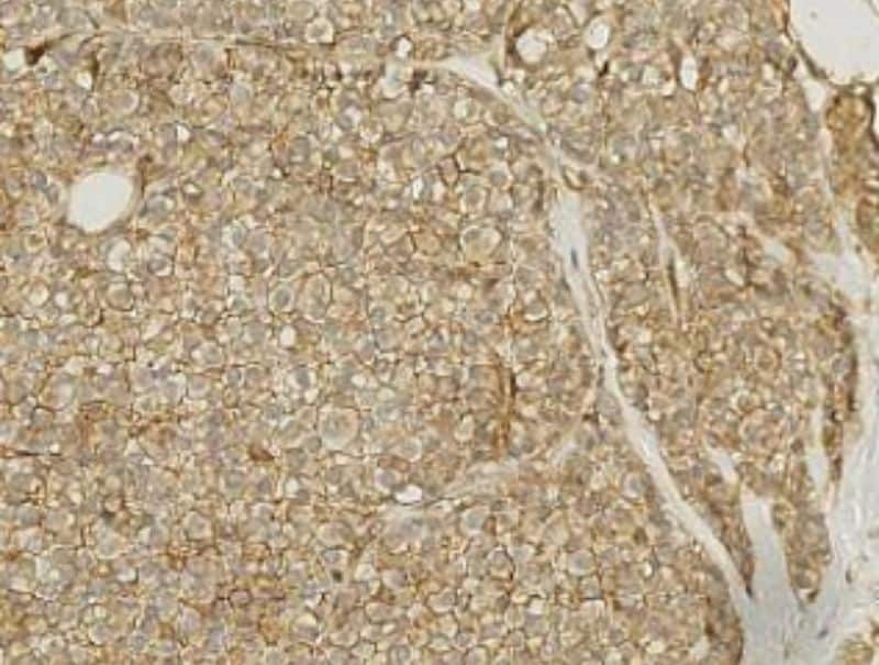 VisioPharm's NBCN1, Breast Cancer is available in Pathflow.