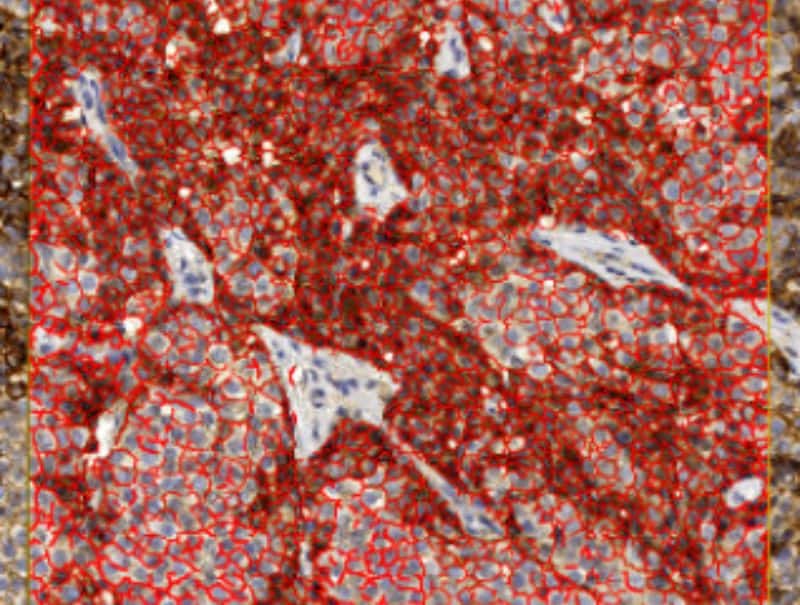 VisioPharm's NHE1, Breast Cancer is available for Pathflow.