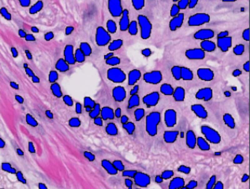 VisioPharm's Nuclei Detection, AI (Brightfield) is available in PathFlow
