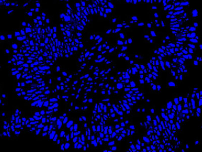 VisioPharm's Nuclei Detection, AI (Fluorescence) is available in Pathflow