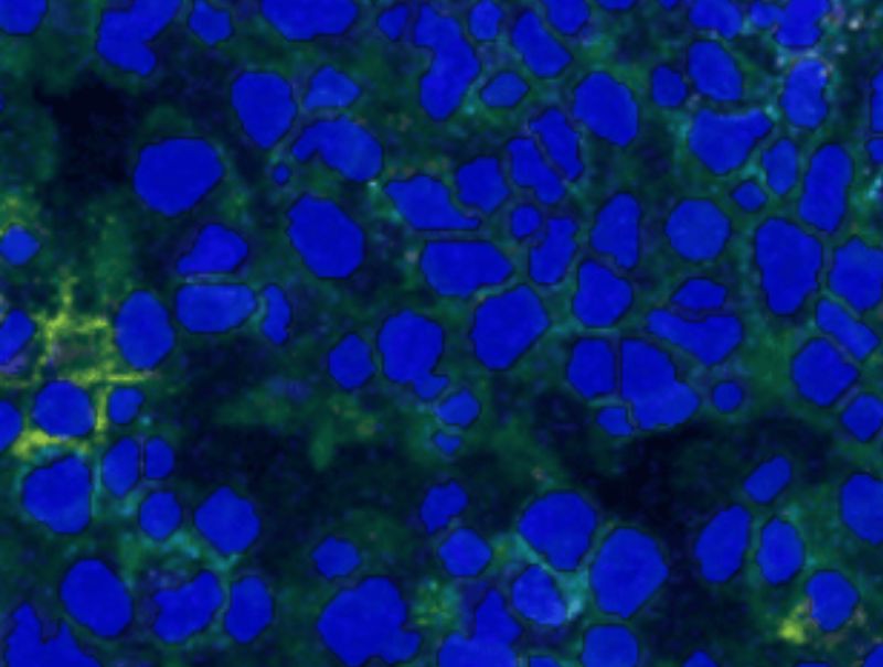 VisioPharm's Nuclei Detection, AI (IMC) is available in Pathflow