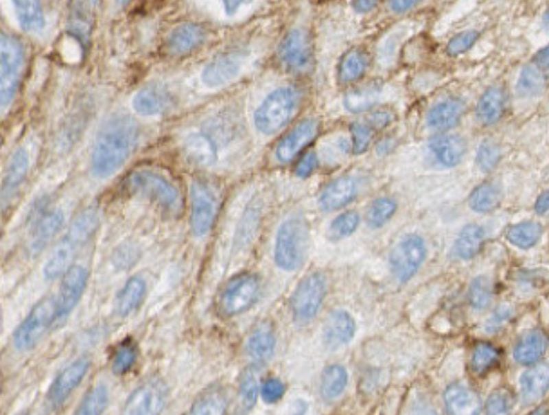 VisioPharm's PD-L1, Melanoma, TME is available in Pathflow