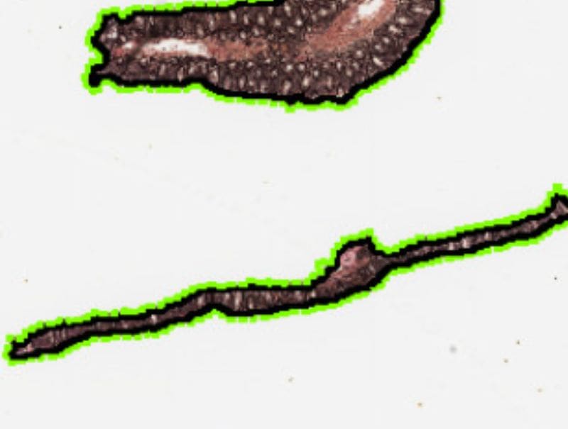 VisioPharm's Van Gieson, Collagenous Colitis is available in Pathflow